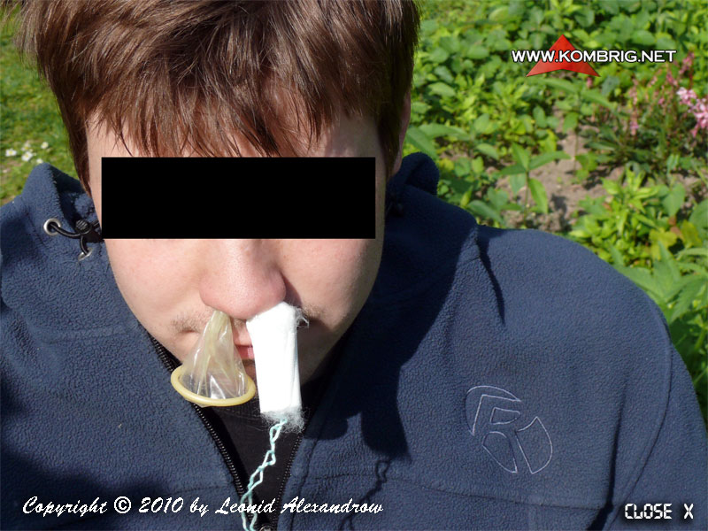 Двусторонняя тампонада носа презервативом и гинекологическим тампоном